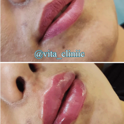 vita-clinic-insta-18
