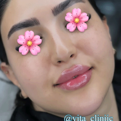 vita-clinic-insta-20